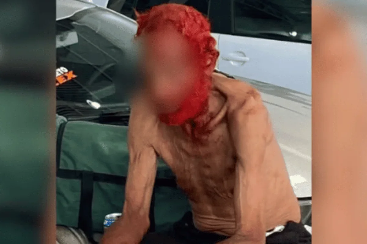 Empresário vira réu por pintar cabelo e barba de idoso em situação de rua