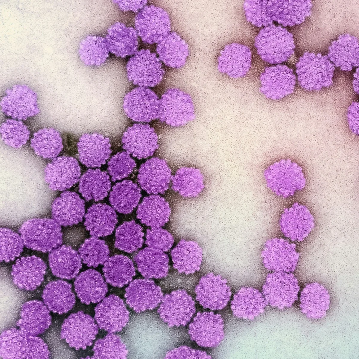 Terapia epigenética pode reduzir atividade do vírus da hepatite B