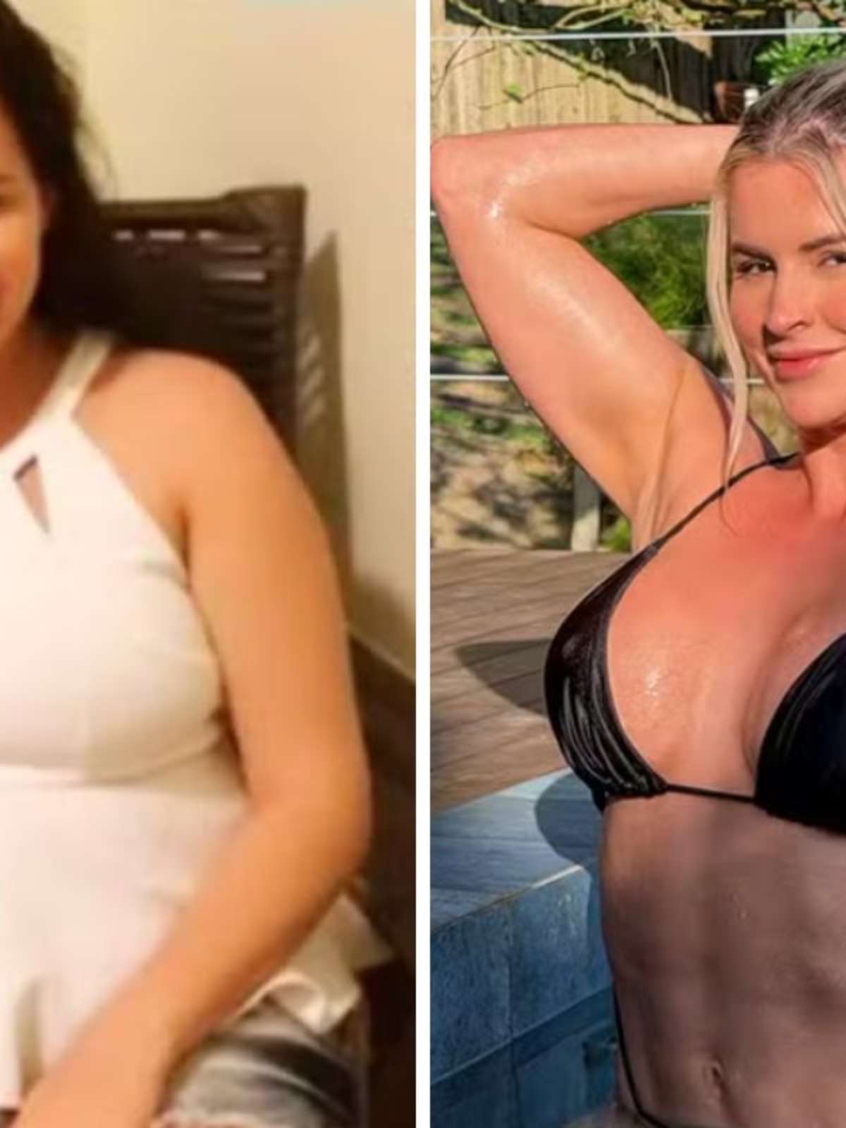 Após perder 20 kg, influencer mostra transformação e admite ter ‘canetafobia’