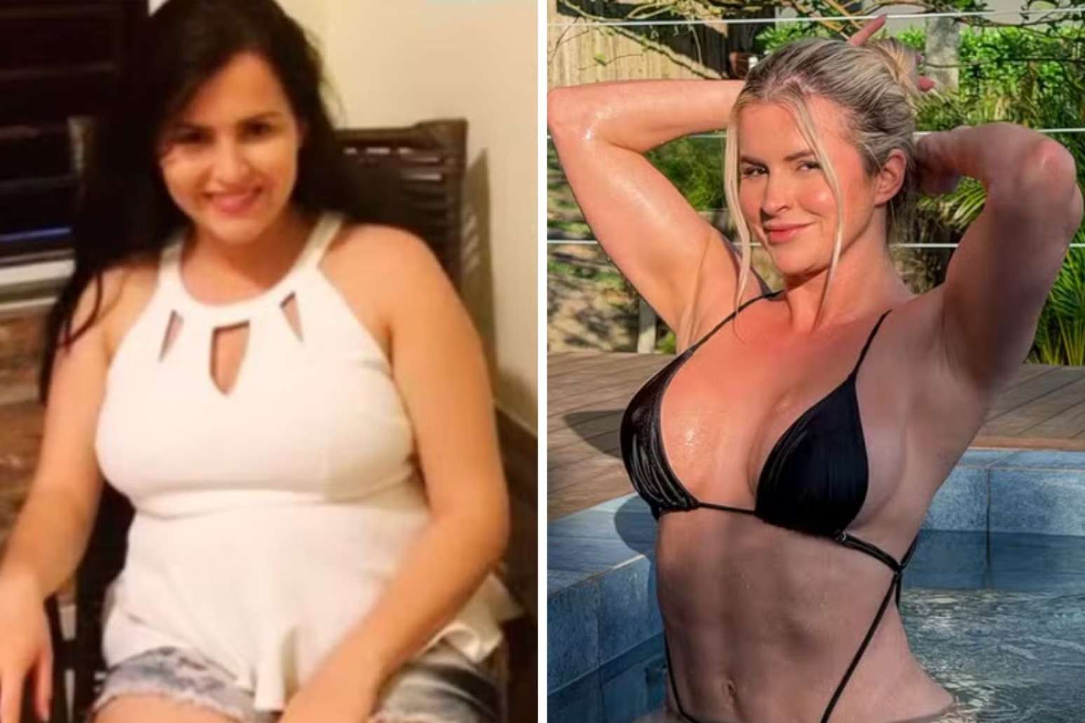 Aline Limas antes e depois do processo de emagrecimento