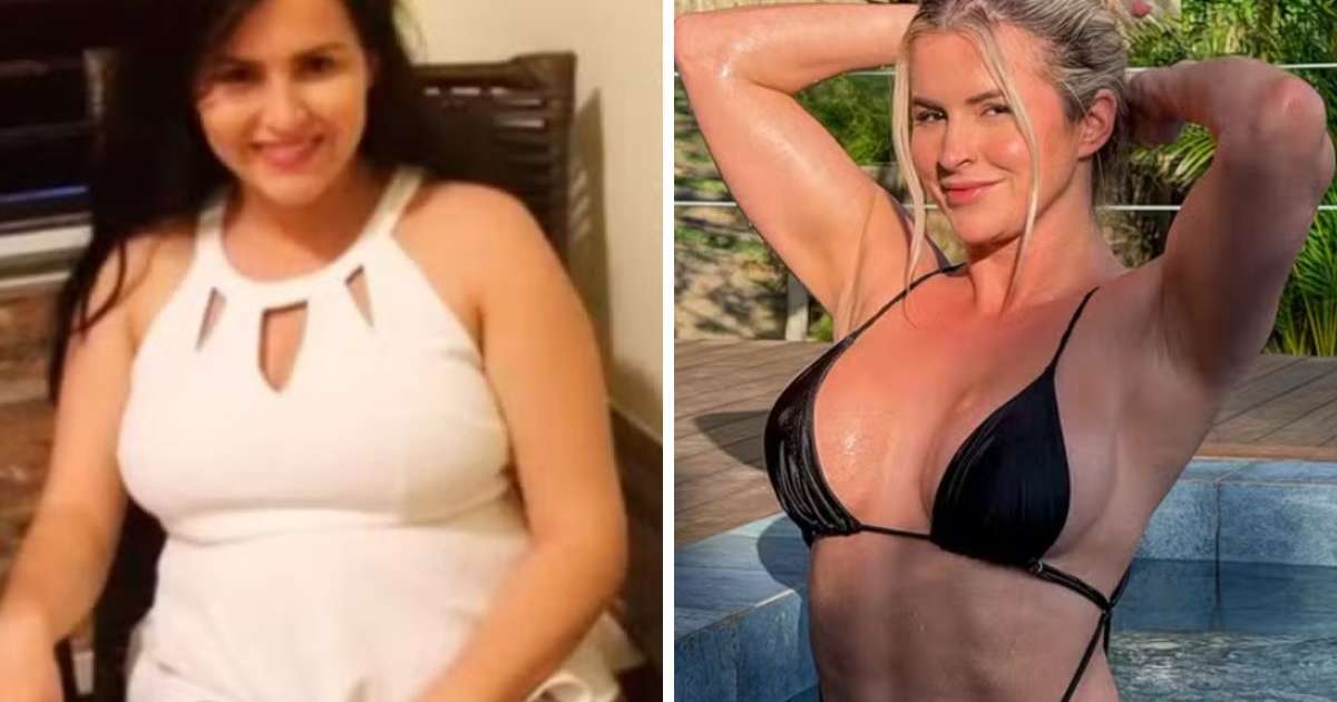 Após perder 20 kg, influencer mostra transformação e admite ter ‘canetafobia’