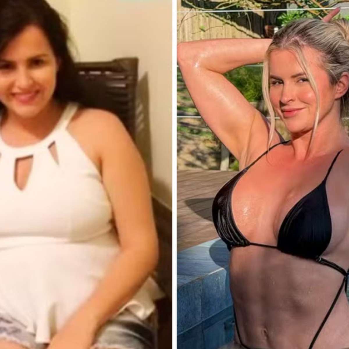 Após perder 20 kg, influencer mostra transformação e admite ter ‘canetafobia’